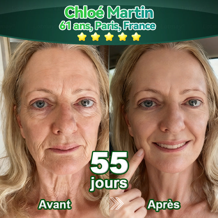 🎄🎅 𝐒𝐩𝐞́𝐜𝐢𝐚𝐥 𝐍𝐨𝐞̈𝐥 -𝟖𝟎% 🎁【𝐄́𝐝𝐢𝐭𝐢𝐨𝐧 𝐄𝐱𝐜𝐥𝐮𝐬𝐢𝐯𝐞 𝐎𝐟𝐟𝐢𝐜𝐢𝐞𝐥𝐥𝐞𝐦𝐞𝐧𝐭 𝐀𝐮𝐭𝐨𝐫𝐢𝐬𝐞́𝐞】𝐃𝐞𝐞𝐯𝐨𝐨® 𝐒𝐞́𝐫𝐮𝐦 𝐎𝐫𝐚𝐥 𝐝𝐞 𝐂𝐞𝐥𝐥𝐮𝐥𝐞𝐬 𝐒𝐨𝐮𝐜𝐡𝐞𝐬 𝐞𝐭 𝐏𝐞𝐩𝐭𝐢𝐝𝐞𝐬 𝐝𝐞 𝐂𝐨𝐥𝐥𝐚𝐠𝐞̀𝐧𝐞 🛒(𝐑𝐚𝐟𝐟𝐞𝐫𝐦𝐢𝐭 𝐞𝐭 𝐓𝐨𝐧𝐢𝐟𝐢𝐞 𝐥𝐚 𝐏𝐞𝐚𝐮 𝐑𝐞𝐥𝐚̂𝐜𝐡𝐞́𝐞 & 𝐑𝐞́𝐝𝐮𝐢𝐭 𝐥𝐚 𝐅𝐨𝐫𝐦𝐚𝐭𝐢𝐨𝐧 𝐝𝐞 𝐑𝐢𝐝𝐞𝐬)🌸